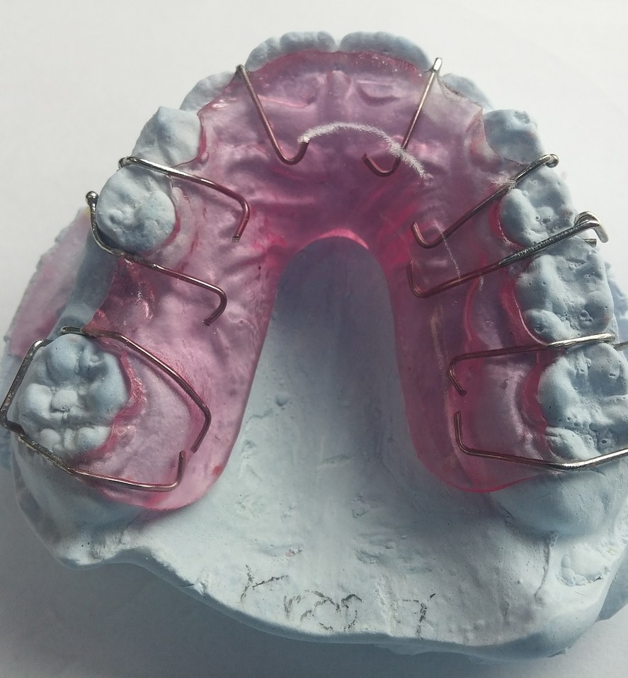 ortodonzia1